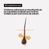 3474637106461 Sampon profesional pentru scalp gras L’Oreal Professionnel Serie Expert Scalp Advanced, cu 3% AHA, 300ml