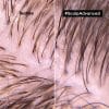 3474637106461_2 Sampon profesional pentru scalp gras L’Oreal Professionnel Serie Expert Scalp Advanced, cu 3% AHA, 300ml