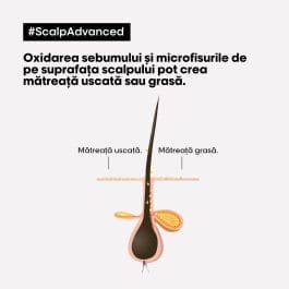 Sampon profesional anti-matreata pentru scalp cu matreata L’Oreal Professionnel Serie Expert Scalp Advanced, cu Pirocton Olamina, 300ml